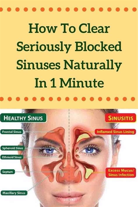 Sinuses Symptoms