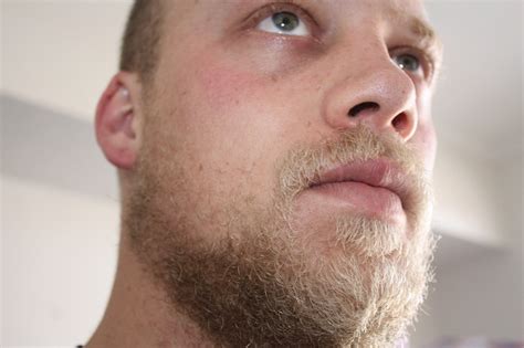 Blonde Beard Progress