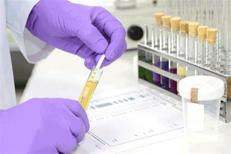 Blood Drug Tests For Employment: What To Expect