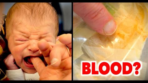 Raising Red Flags: Understanding the Causes and Treatment of Blood in Your Baby's Diaper
