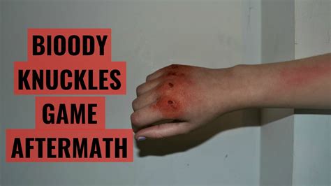 Bloody Knuckles Game