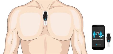 Troubleshoot Poor Skin Contact with Bodyguardian Mini Plus