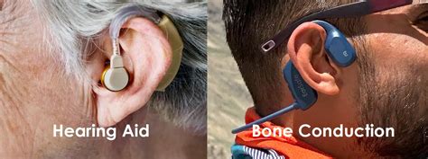 Bone Conduction vs. In-Ear Which is Best