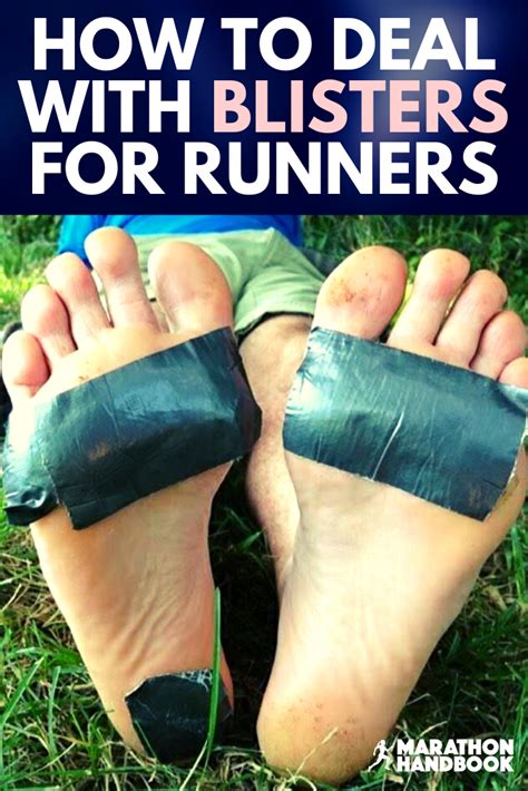 Boston Marathon Training And Blisters