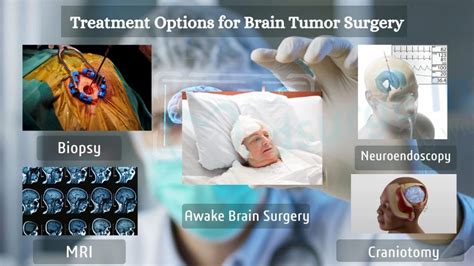 Brain Tumor Surgery: Risks & Benefits Explained