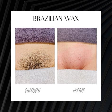 Brazilian Wax Image
