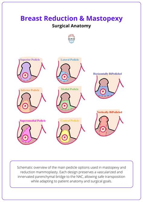 Breast Reduction Surgery: Options & Results