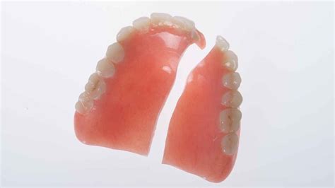 Broken Denture Image