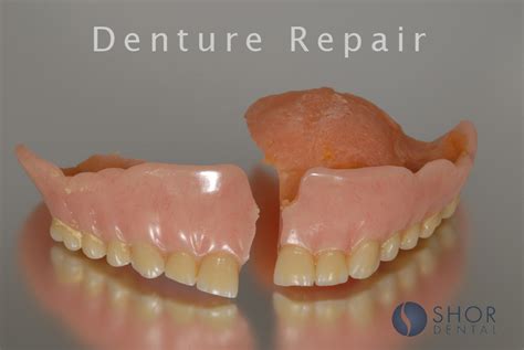 Broken Denture Repair