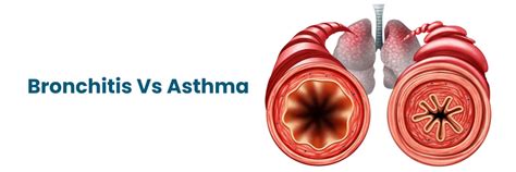Bronchitis vs Asthma: Key Differences