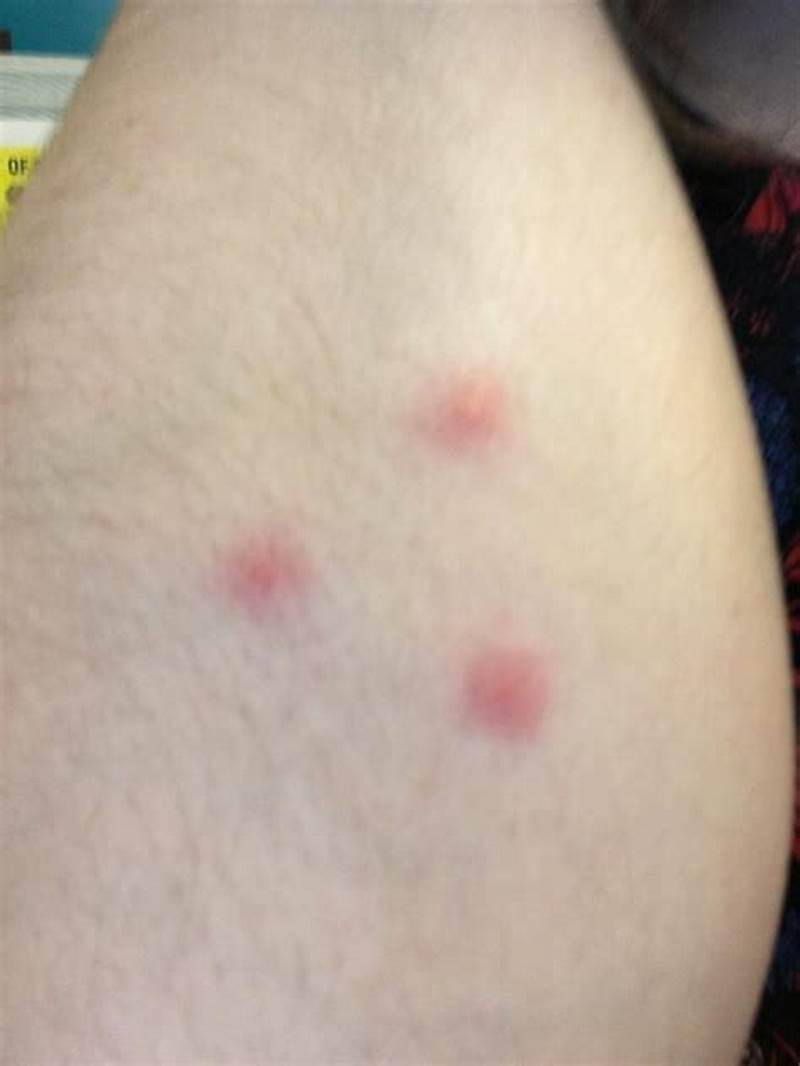 Bug Bites In Triangle Pattern