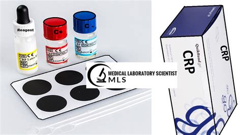 C-Reactive Protein Test and interpretation