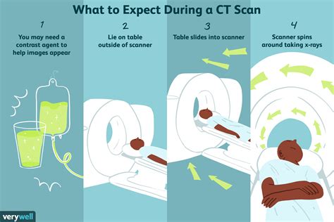 The CT Scan Process