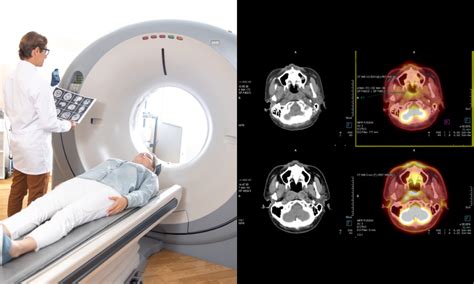 CT Scans: Understand the Process & Results.