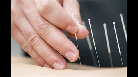 Can Acupuncture Help High Cholesterol