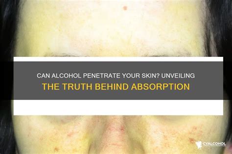 Unlocking the Truth: The Myth of Topical Alcohol Absorption Demystified