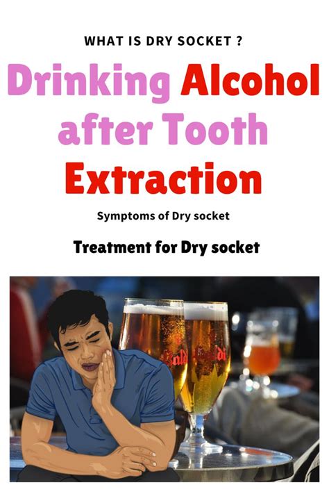 Can You Drink After A Root Canal