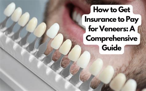 Can You Get Veneers With Insurance