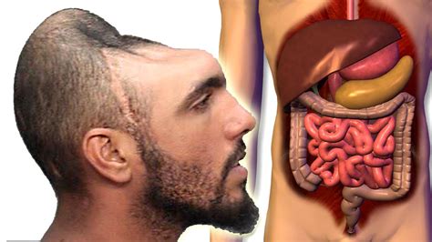 The Unthinkable Truth: Is it Possible to Survive Without Skin?