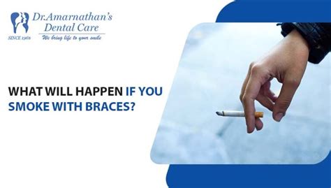 Can You Smoke With Retainers In