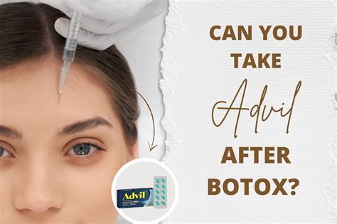 Can You Take Advil Before Botox