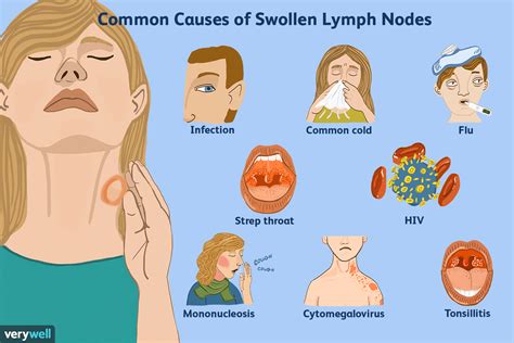 Cancer vs. Infection: Lymph Node Differences Explained.