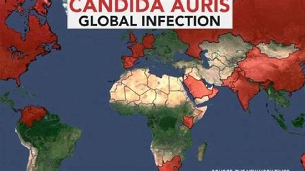 Candida Auris Outbreak 2024
