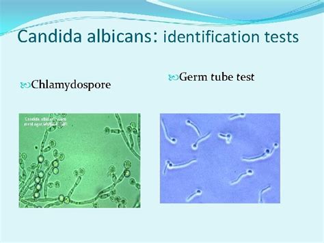 Candida Albicans Identification Test and interpretation