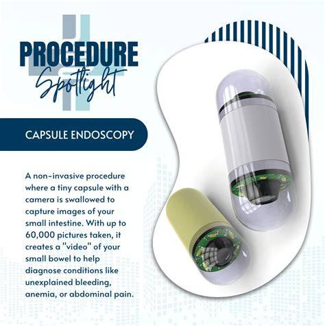 Capsule Endoscopy: See Inside, Feel Better.