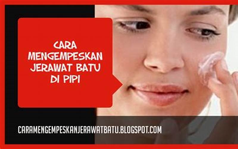 Cara Alami Mengempeskan Jerawat Batu