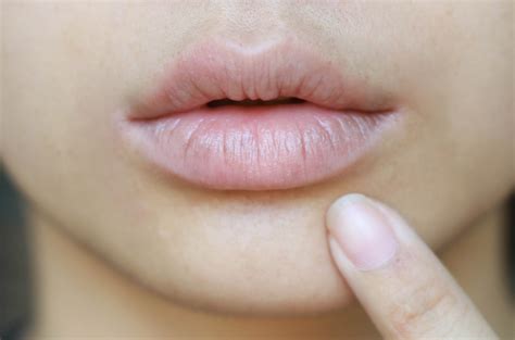 Cara Mengatasi Bibir Kering Pecah2