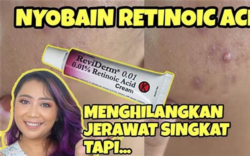 Cara Mengatasi Jerawat Dengan Obat Retinoid