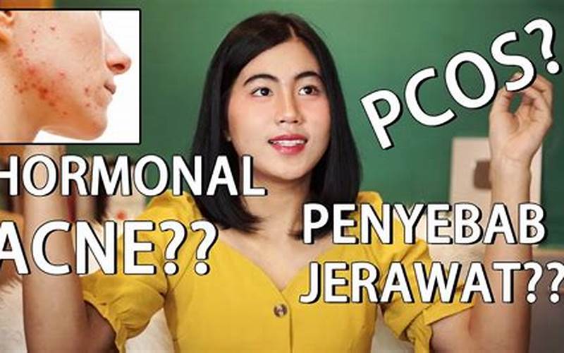 Cara Mengatasi Jerawat Hormon Pada Wanita