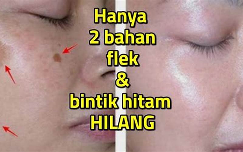 Cara Menghilangkan Flek Hitam Di Hidung