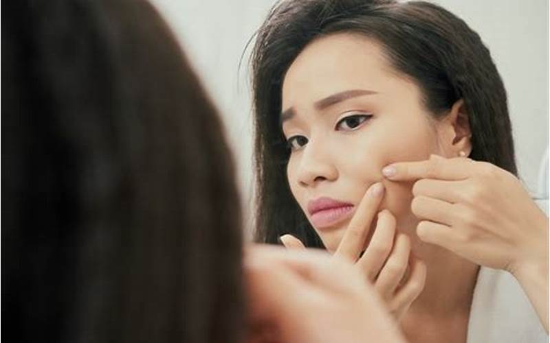 Cara Menghilangkan Jerawat Acne Dengan Cepat Dan Efektif