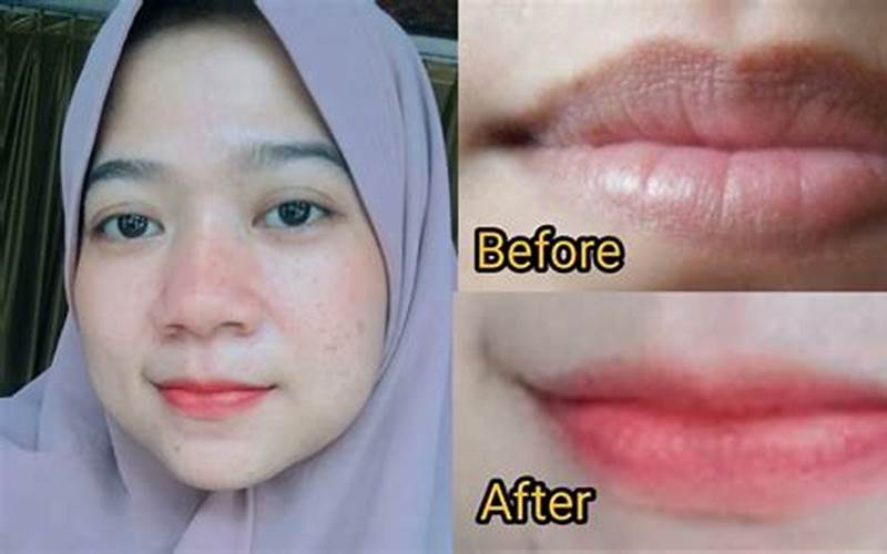 Cara Menghilangkan Warna Hitam Di Bibir
