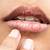 Cara Mengobati Bibir Kering Dan Gatal