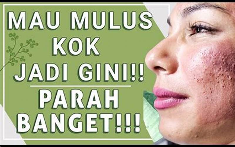 Cara Mengobati Jerawat Acnes Tempelan Dengan Cepat Dan Aman