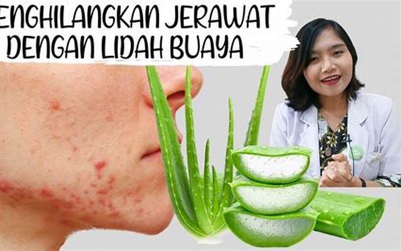 Cara Pakai Lidah Buaya Untuk Jerawat