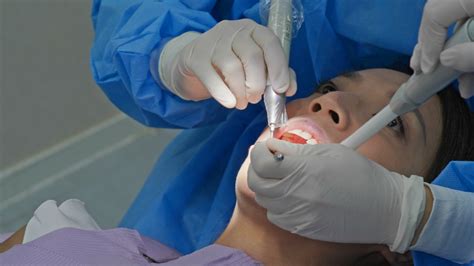 Cara Merawat Gigi Setelah Melakukan Scaling