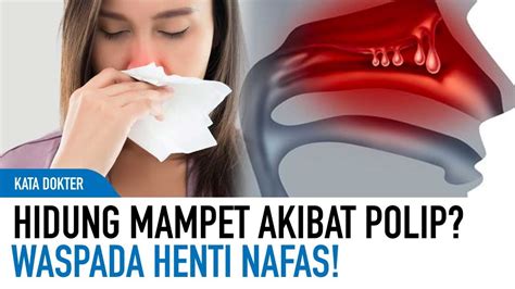 Cara mengatasi hidung mampet akibat polip hidung