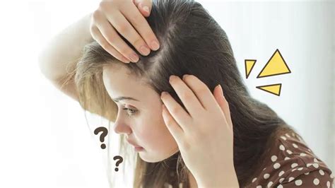 Cara Mencegah Kutu Rambut Kembali