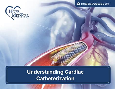 Cardiac Catheterization: Understand Risks, Recovery & Results.