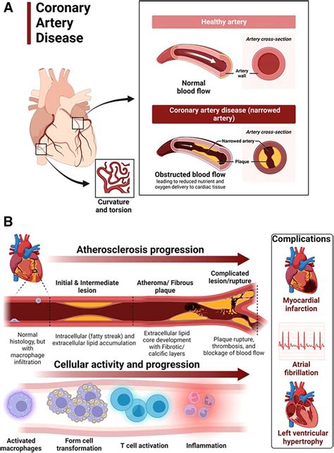 Cardiovascular Damage