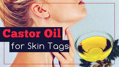 Revive Your Skin: Unveiling the Wonders of Castor Oil for Banishing Skin Tags!