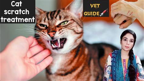 Cat Scratch Treatment: First Aid & Recovery