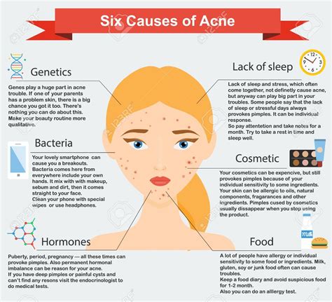 Acne Types, Symptoms, Causes & Treatments