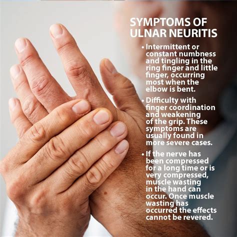 Causes, symptoms and treatments for ulnar neuritis