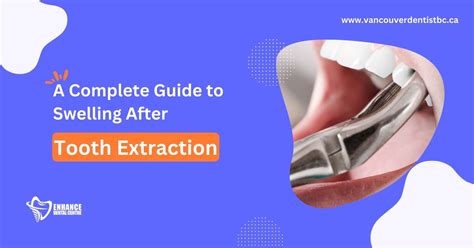 Causes of Swelling after Tooth Extraction