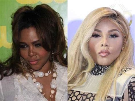 The Heartbreaking Truth About Celebrities' Bleached Skin: Exposed